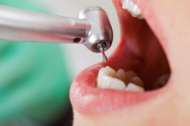 Best Knocked-Out Tooth Emergency  in Rinna, VA